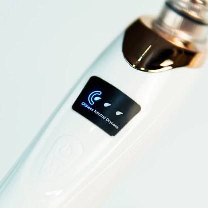 Pore Vacuum Blackhead Remover for Face – 3 Suction Levels